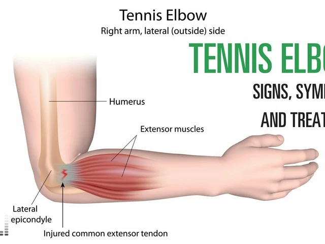 Should I stop playing tennis for a while if I have tennis elbow?